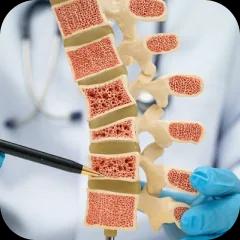 Bones And Joint Disorder